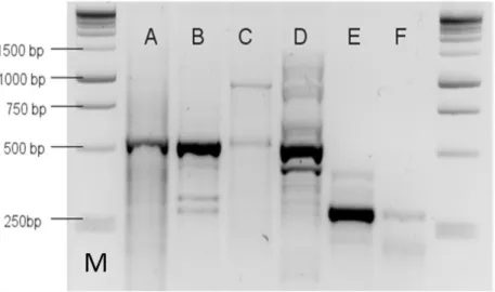 ábra  E  primerkombináció),  ami  alapján  feltételeztük  a  CC-NBS-LRR  rezisztenciagén  analógok jelenlétét a kajszi genomban