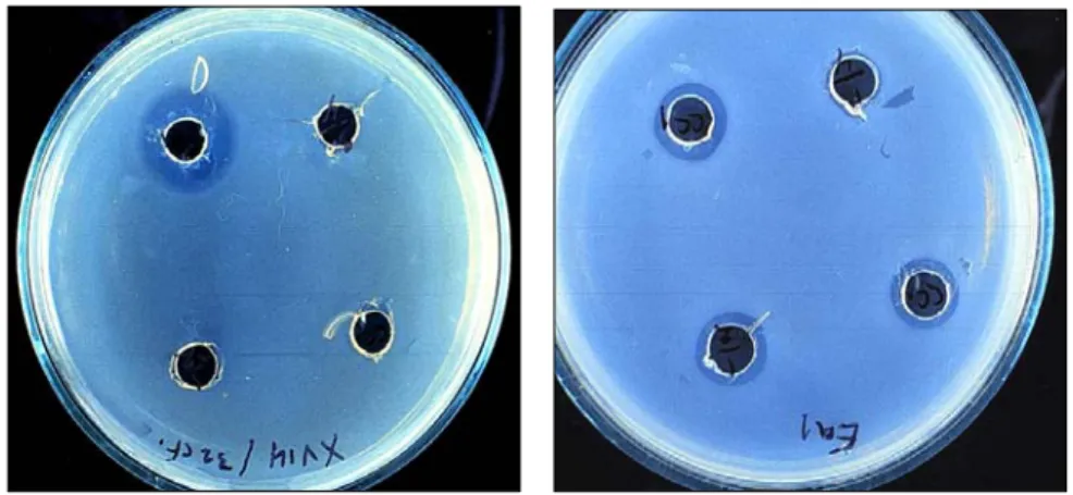 Fig. 16.  Reduction of growth of some bacterial pathogens by culture filtrate of isolate  HIP32 at different degrees of dilutions