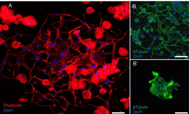 16. ábra A D. ananassae sokmagvú óriássejtjeinek sejtváz festése. TRITC-Phalloidin festéssel az aktin  sejtváz (A) és anti-tubulin festéssel a mikrotubuláris hálózat a normál sejtben (B) és kolhicin kezelést 