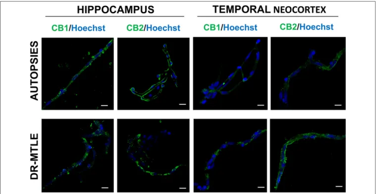 FIGURE 1 | Immunofluorescence staining of CB1 and CB2 receptor proteins in microvessels isolated from the hippocampus and temporal neocortex of non-epileptic autopsies and patients with DR-MTLE