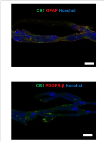 FIGURE 5 | Upper panel: double-labeling immunofluorescence staining of CB1 receptors and GFAP in microvessels isolated from the hippocampus of a non-epileptic autopsy