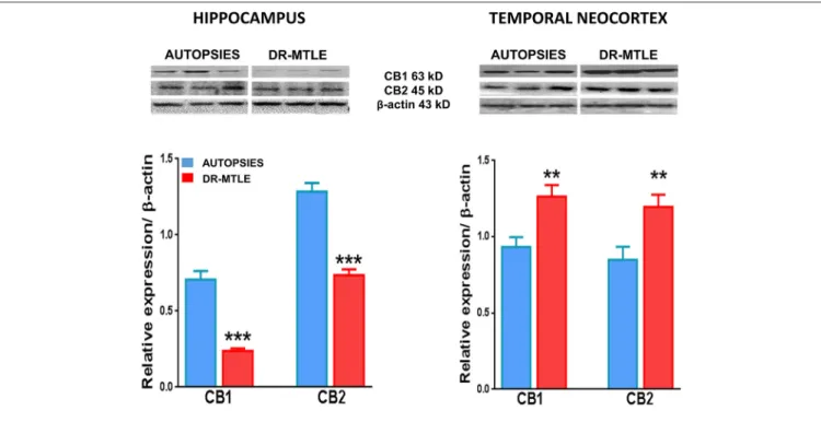 FIGURE 6 | CB1 and CB2 protein expression in human microvessels obtained from non-epileptic autopsies and patients with DR-MTLE