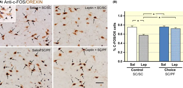 FIGURE 3  Leptin fails to suppress OX neuron activity in the LHA during hedonic eating