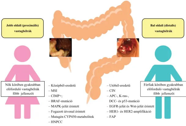1. ábra A jobb és a bal oldali vastagbéldaganatok jellemző klinikai és molekuláris biológiai tulajdonságai