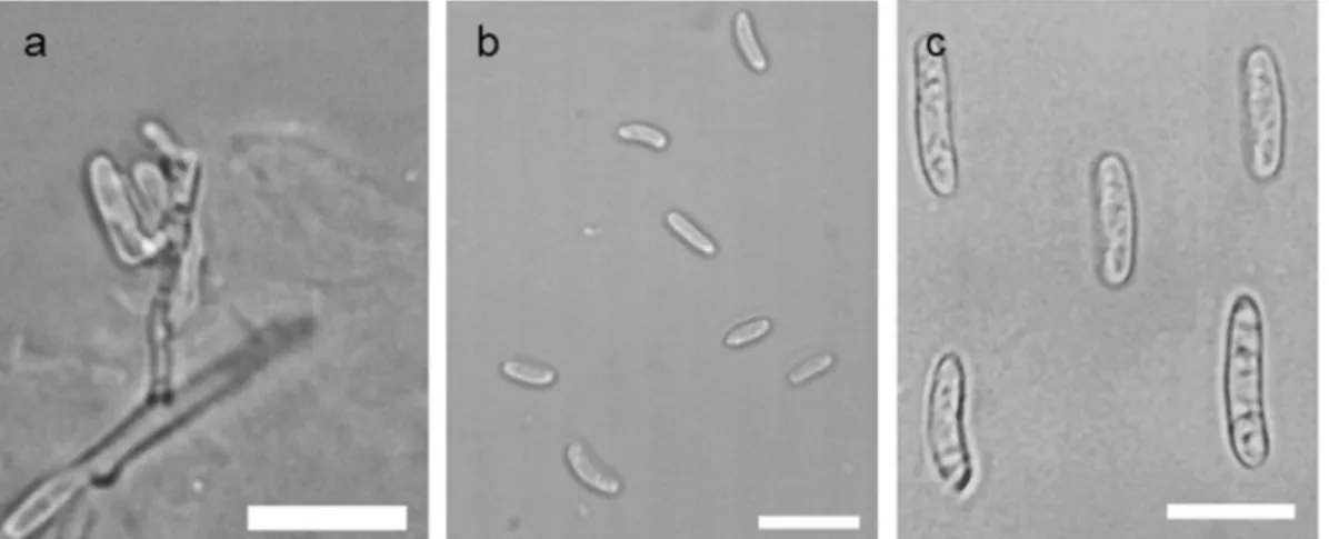Fig. 3 Macro- and microconidia production of two Hungarian Neofabraea kienholzii isolates, induced on OA