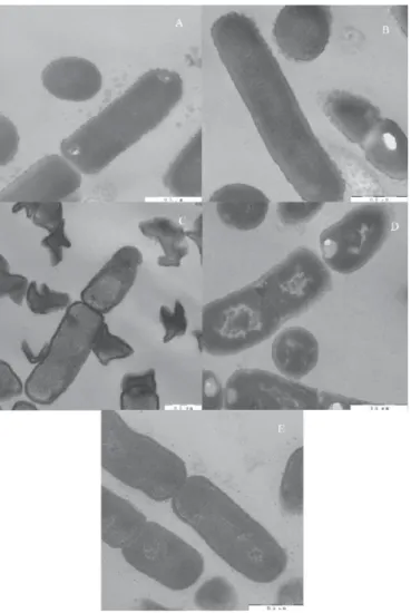 Fig. 2. Eﬀ ects of diﬀ erent treatments on cell surface structure of L. rhamnosus A: Untreated; B: acid-treated; C: alkaline-treated; D: treated at 121 °C; E: treated at 100 °C