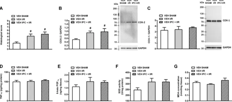 Fig. 8. Panels A-D: Gelatinolytic activities of matrix metalloproteinase-2 (MMP-2, 72 kDa, A; 75 kDa, B) and MMP-9 (86 kDa, C; 92 kDa, D) in plasma samples of vehicle-treated rats subjected to sham operation or cardiac ischemia/reperfusion injury (I/R) wit