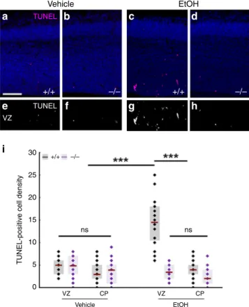 Fig. 7 ABHD4 is necessary for cell death caused by fetal alcohol exposure. Compared to vehicle-treated mice (a, b, e, f), increased number of TUNEL-positive dead cells is seen in ethanol-treated wild-type ( + / + ), (c, g), but not in Abhd4- knockout ( − /