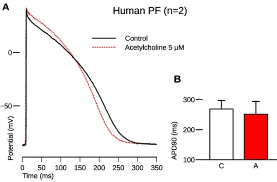 Figure 5. Representative action potential showing the effect of acetylcholine (5 μM, red dotted line) on a  Purkinje fiber taken from a human donor heart (A)