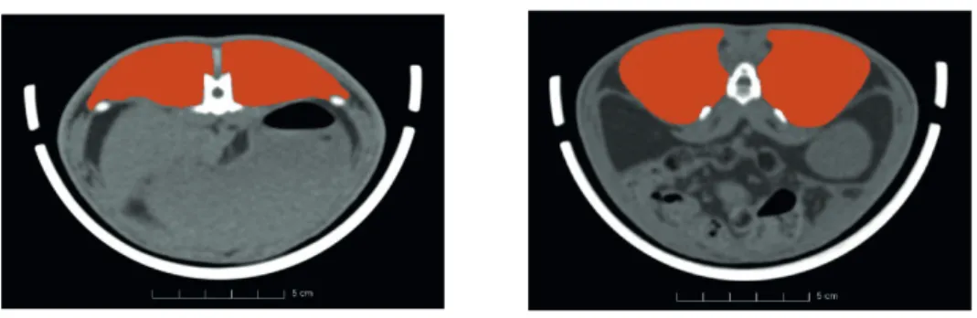 Figure 2 Illustration of the segmentation of the loin muscle in rabbits. Red colour indicates loin  8 muscle areas