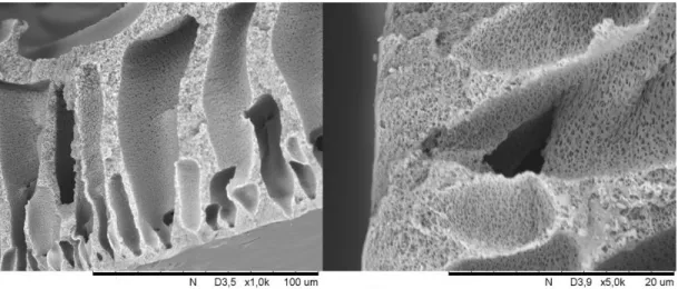 3. ábra PVDF UF membrán elektronmikroszkópos képe 1.000x-es és 5.000x-es nagyításban 