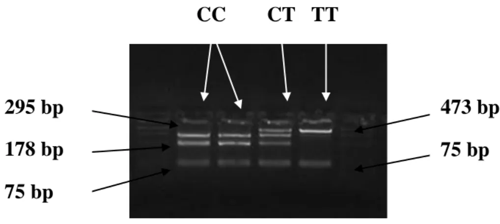 19. ábra: A szarvasmarha TG gén 5’ UTR változatai 4%-os agaróz gélen.   