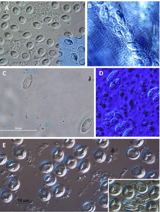 Figure 6. (A) Myxobolus tambroides sp. n.; (B) Myxobolus sp. I; (C) Myxidium sp. II; (D) Myxidium sp