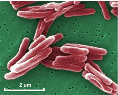 4. ábra: Mycobacterium tuberculosis 15549-szeres szkenning-elektronmikroszkópos, színezett  képe 