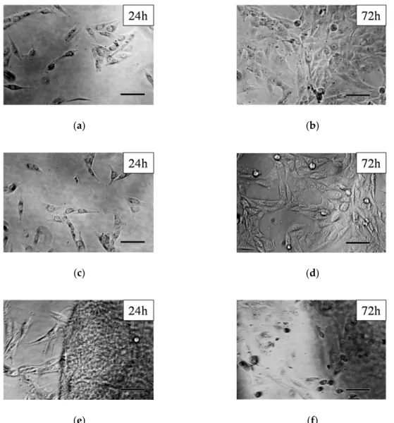 Figure 5. Phase-contrast microscopical images of MG-63 cells: controls after 24 (a) and 72 h (b), PASP  control after 24 (c) and 72 h (d), and PSI-AAmp after 24 (e) and 72 h (f) incubation