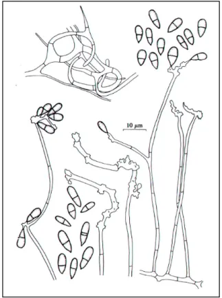 6. ábra. Arthrobotrys superba (O ORSCHOT VAN  1985) 