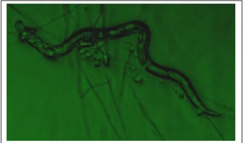 9. ábra. Arthrobotrys oligospora KXURNYHW JRPEDiOWDOIRJViJEDHMWHWW