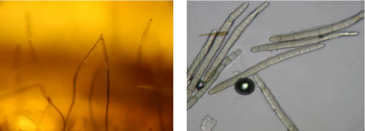 2. ábra. A Drechslera- tritici-repentis konídiuma a levélen képződött   konídiumtartókon (A)                            és mikroszkópi preparátumban (B) 