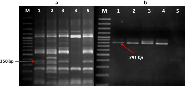 Fig  4.  Electrophoretic  pattern  of  the  DdeI  digested  CP60  CAPS  marker  (a)  and  marker 221R (b)