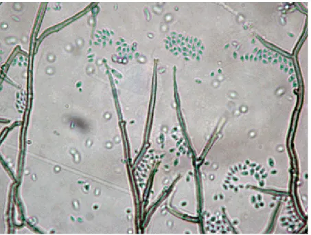 12. ábra: A Phaeoacremonium aelophilum konídiumai (Fotó: Gubler) 