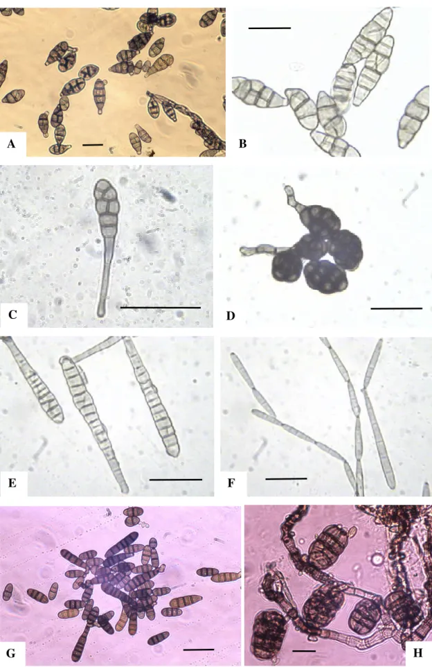 9. ábra.  Alternaria alternata (A), A. tenuissima (B), A. infectoria (C), A. chlamydospora  (D)  konídiumai;  Embellisia  dennisii  primer(E)  szekunder  és  tercier  (F)  konídiumai; 
