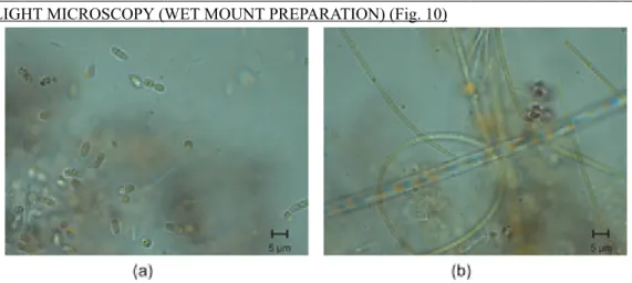 Fig. 10. Bright-field micrograph of microorganisms from natural waters. Rod and filamentosus shape bacteria from an artificial pond.