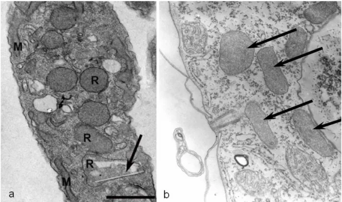 2.15. ábra. a) Rezervoszómák (R) Trypanosoma cruzi citoplazmájában (nyíl: kristályos lipidzárvány, skála: 0,5 μm; forrás: Pereira és mtsai 2011) b) Peroxiszómák, belsejükben néhány rövidke tubulussal (nyíl, Tetrahymena