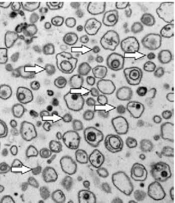 2.20. ábra. Mitoszómák, Giardia-ból sejtfrakcionálással izolált homogén méretű organellumok (Nyilak!) (forrás: