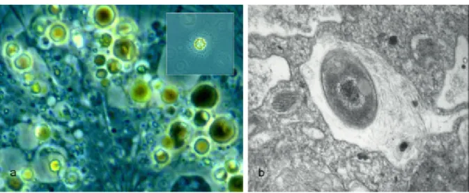 3.14. ábra. Emésztőűröcskék a) egy napállatka (Heterophrys myriapoda) alga-tápláléka az emésztőűröcskékben b) az endoszómában egy házas amőba (Arcella intermedia) által elfogyasztott élesztősejt látható (b – Dr