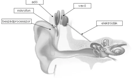 1. ábra :A cochlea implantátum részei A szervezeten kívüli részek a következõk: