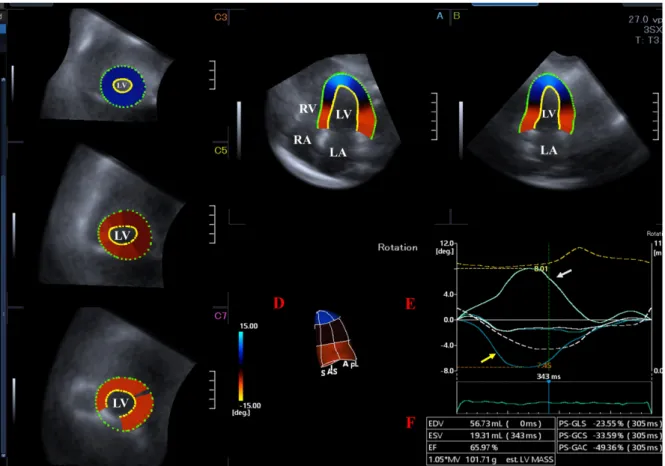 Fig. 1. Left ventricular (LV) rotational mechanics assessed by three-dimensional (3D) speckle-tracking echocardiography