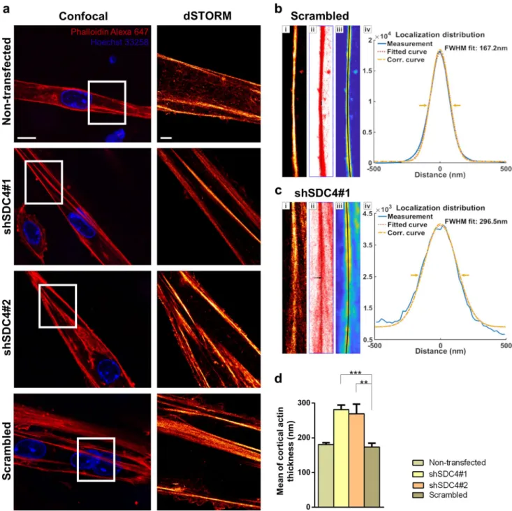 Fig. 5    Examination of cortical actin thickness in myotubes using  dSTORM superresolution microscopy