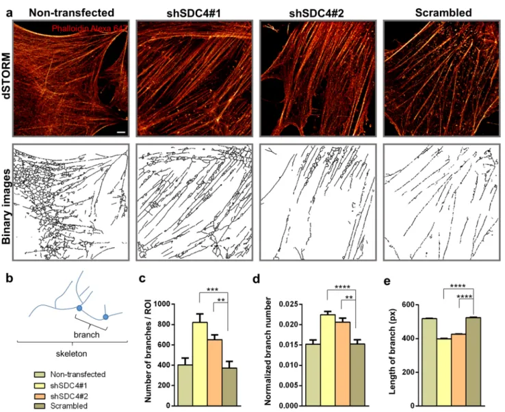 Fig. 6    dSTORM analysis of the actin network of differentiated  cells. a Phalloidin-stained (Alexa 647, red) representative dSTORM  and skeletonized binary images of a non-transfected cell line, two  syndecan-4 silenced (shSDC4#1 and shSDC4#2) cell lines