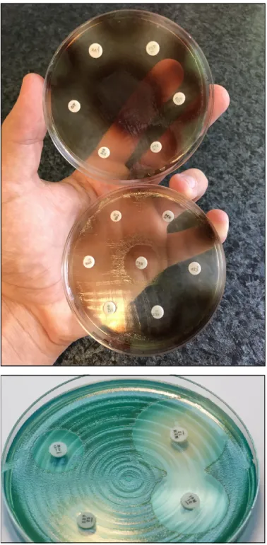 Figure 1. P. aeruginosa antimicrobial susceptibility testing using disk diffusion on Mueller-Hinton  agar plates