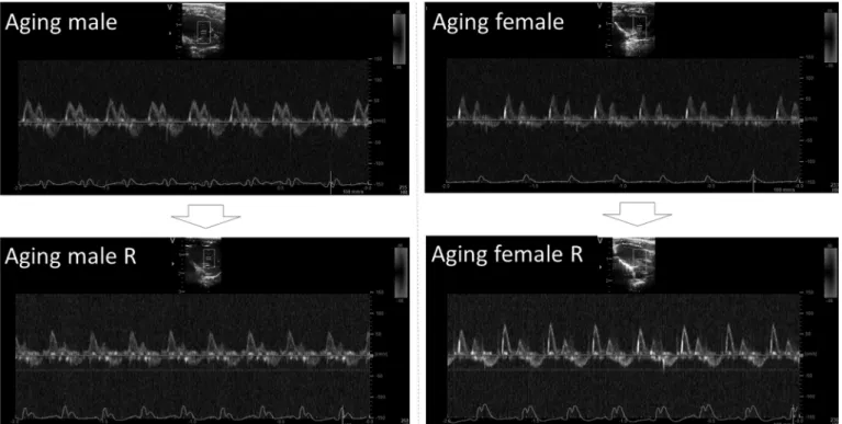 Figure 2. Representative Doppler echocardiographic images of transmitral in ﬂ ow from listed groups
