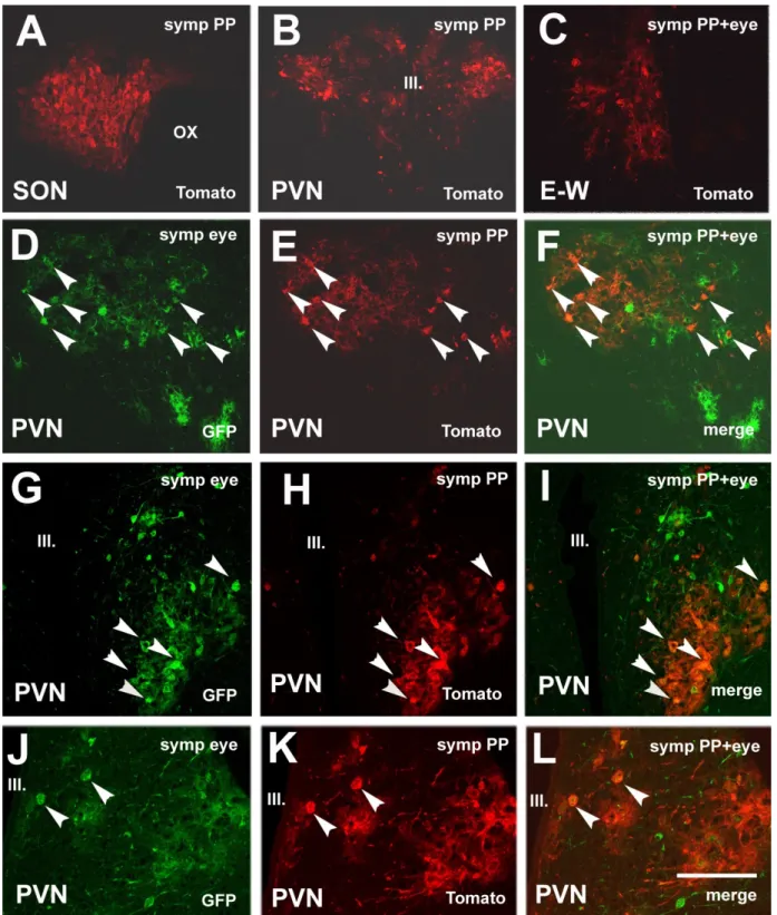Figure 4. Microphotographs showing virus labeling after inoculation of the pituitary with Ka-Vhs-CHR-memTomato-A-RV  and the eye with Ka-gEI-memGFP-RV in sympathectomized rats