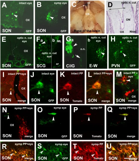 Figure 5. Microphotographs showing virus-labeled neurons in various groups. (A) Ka-gEI-memGFP-RV labeling in the  SON of an intact rat