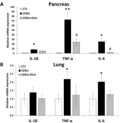 Figure 2. PARP1 activation mediates the inflammatory response in cerulein-induced CP. Olaparib- Olaparib-treated animals showed a decrease in relative expression of inflammatory markers in tissue  ho-mogenates of (A) pancreases and (B) the lungs