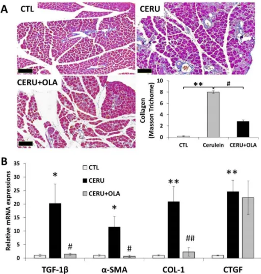 Figure 3. Olaparib inhibits fibrosis in chronic pancreatitis. Mice were treated with either repeated doses of cerulein or cerulein + olaparib for four consecutive weeks (for details see the Materials and Methods section)