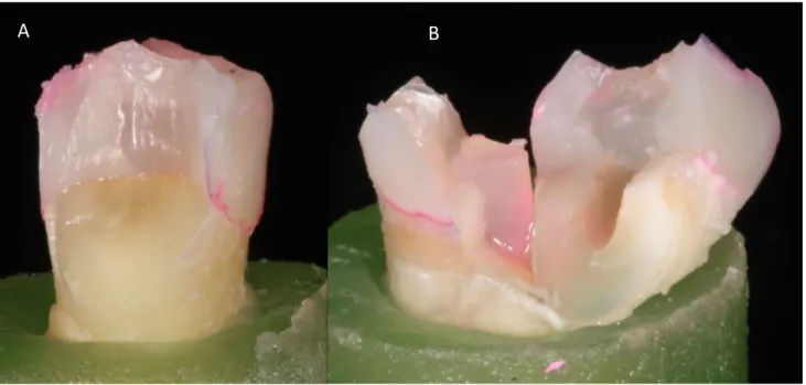 Fig. 3    Photographs of restorable (A) and non-restorable (B) fracture mode of the tested specimens