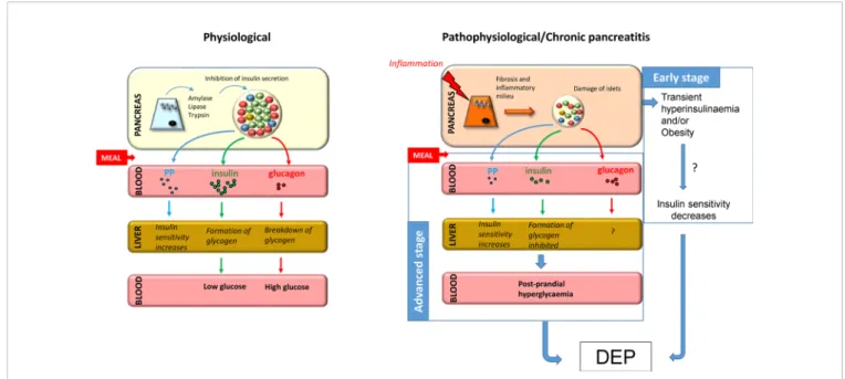 FIGURE 1 | Putative mechanism for the development of DEP in CP. Under normal conditions, food ingestion triggers secretion of enzymes from acinar tissue, insulin from beta cells, and pancreatic polypeptide from PP cells and inhibits secretion of glucagon f