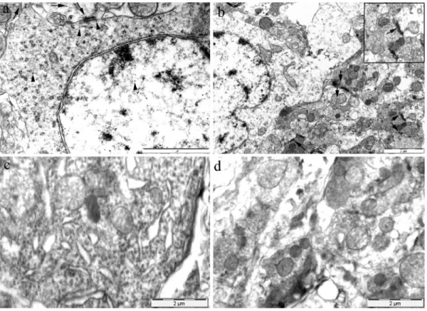 Fig. 7. Representative transmission electron microscopy photomicrographs of dendrin immunoreactivity in dorsal horn neurons of the spinal cord