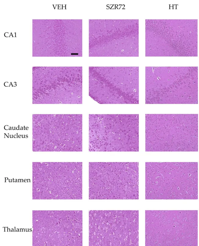 Figure 9. Representative photomicrographs of H&amp;E stained sections from the hippocampal CA1/CA3 subfields, the cau- cau-date nucleus, the putamen, and the thalamus
