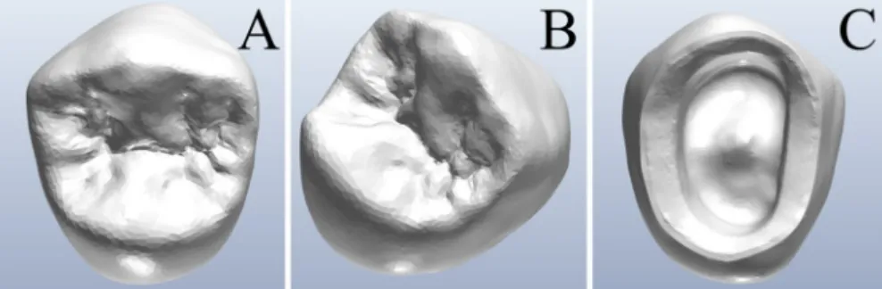 Fig.  6. Details  of  the  3D-printed  and  milled  monolithic zirconia crowns (MZCs)