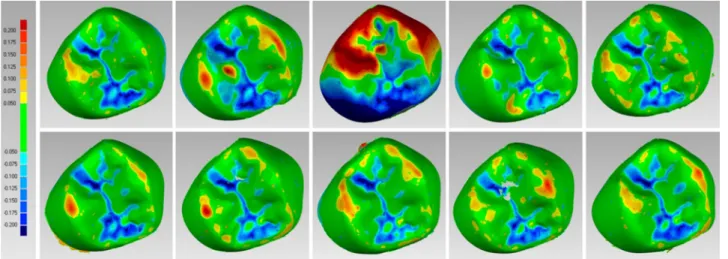 Fig. 8. Details of the colorimetric map generated in the reverse engineering software (Control X ® , Geomagic, Morrisville, NC, USA) for the occlusal surface eval- eval-uation of the ten 3D-printed crowns (test group)