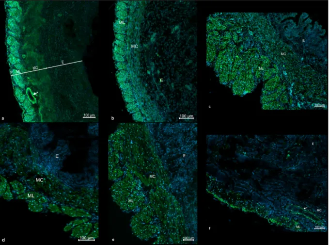Fig. 6. Representative fluorescent micrographs of cryosections from the uterus of non-pregnant rat (A), and on gestational days 5 (B), 15 (C), 18 (D), 20 (E) and 22  (F) after Kiss1r immunohistochemistry (green)