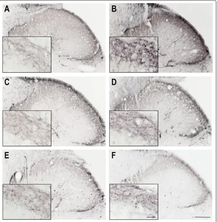 Fig. 1 CGRP immunoreactivity 2.5 h after IS treatment Representative photomicrographs of the CGRP expression in the trigemino-cervical segments after 2.5 h
