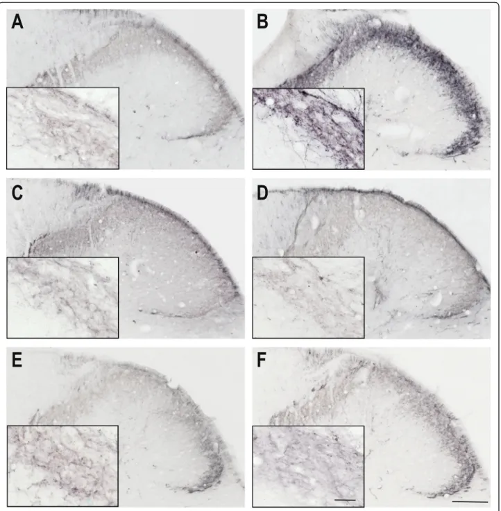 Fig. 2 CGRP immunoreactivity 4 h after IS treatment Representative photomicrographs of the CGRP expression in the trigemino-cervical segments after 4 h