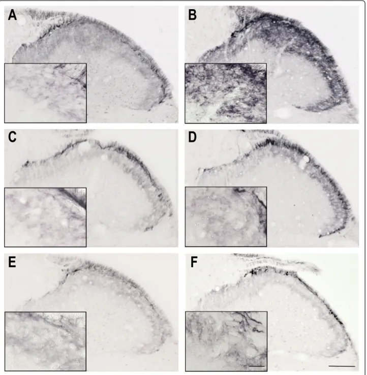 Fig. 4 TRPV1 immunoreactivity 4 h after IS treatment Representative photomicrographs of the TRPV1 expression in the trigemino-cervical segments after 4 h