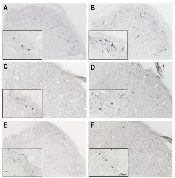 Fig. 5 nNOS immunoreactivity 4 h after IS treatment Representative photomicrographs of the nNOS expression in the trigemino-cervical segments after 4 h